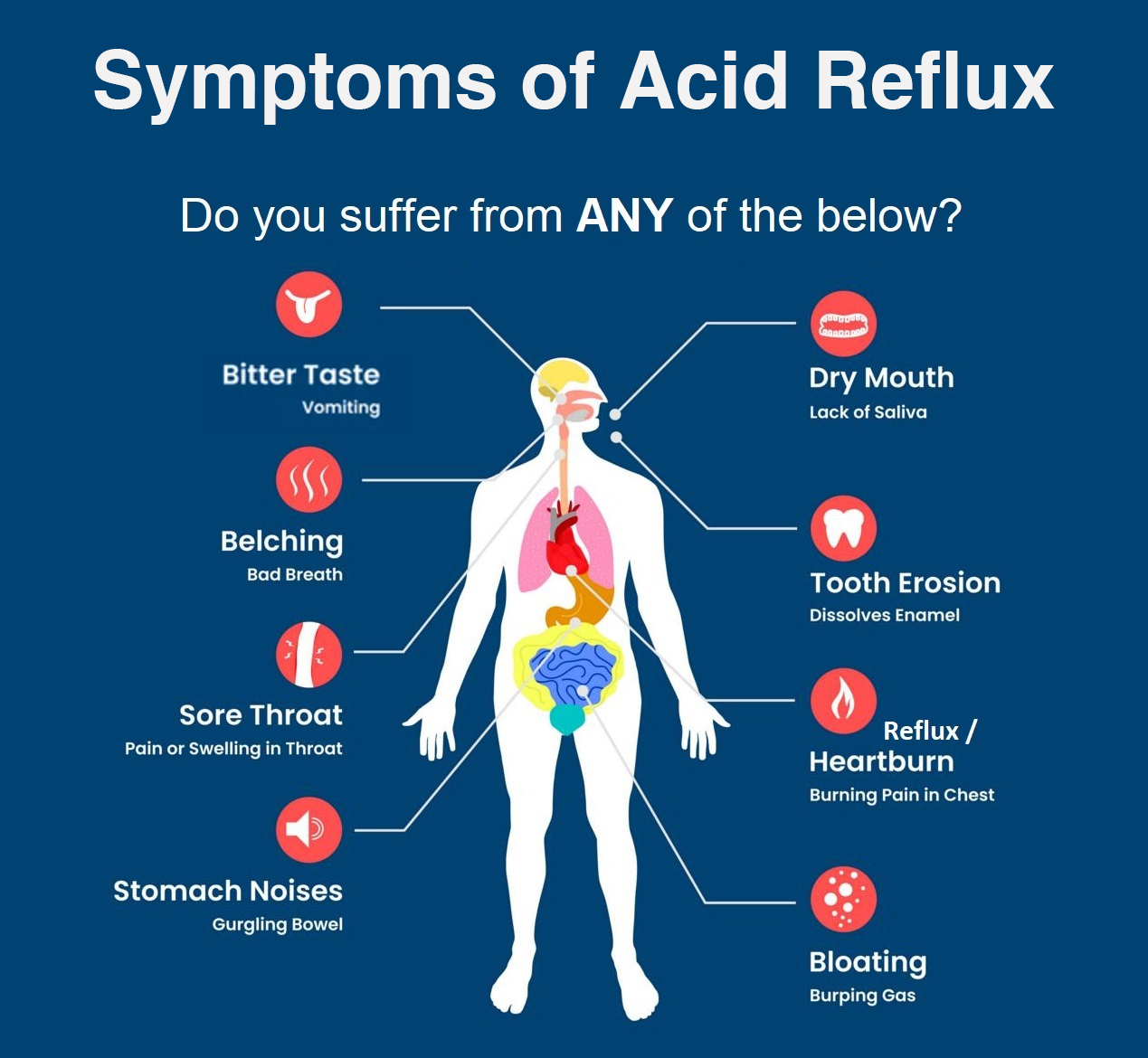 what is acid reflux